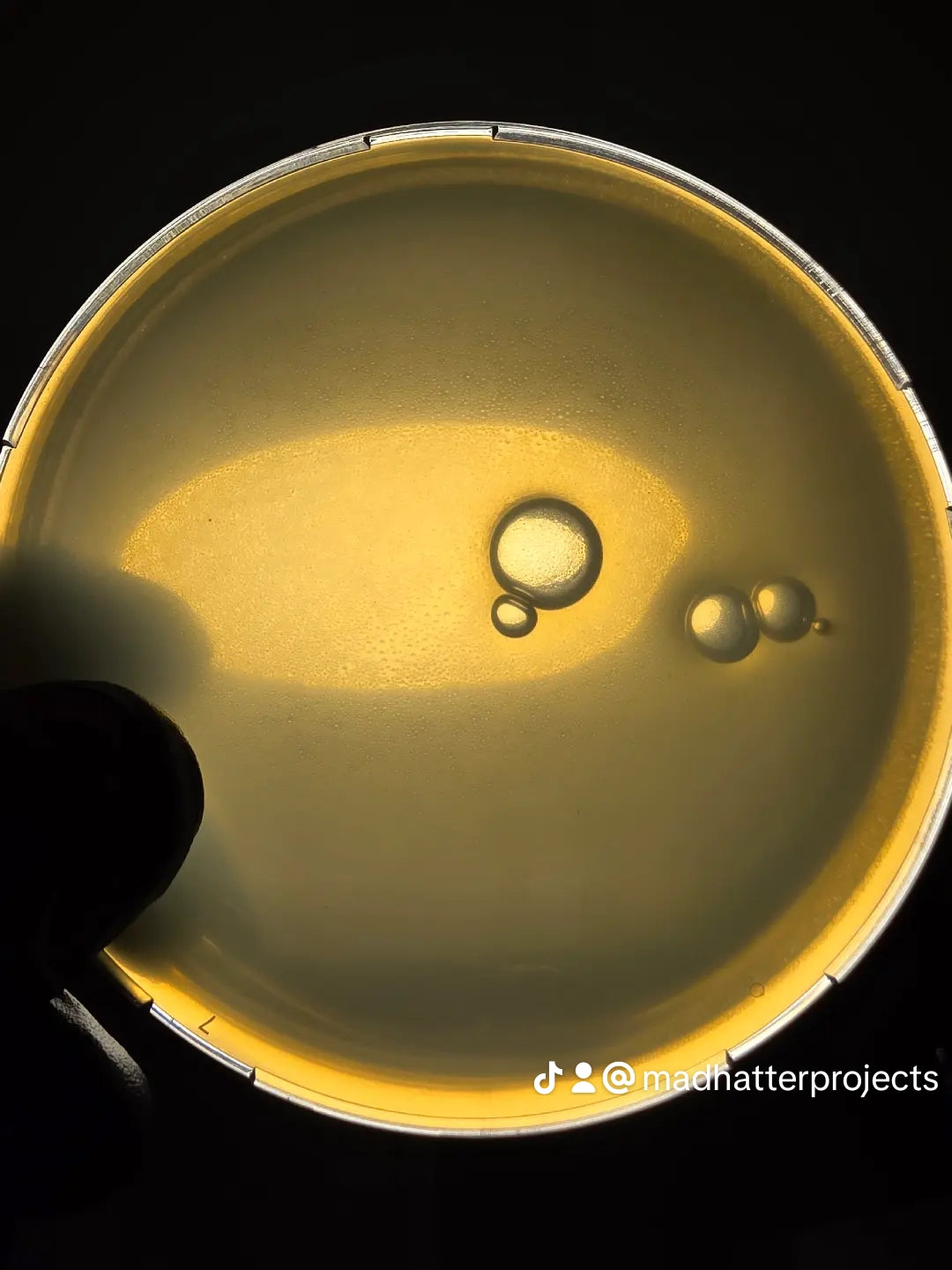 16x M.E.Y.A. agar plate